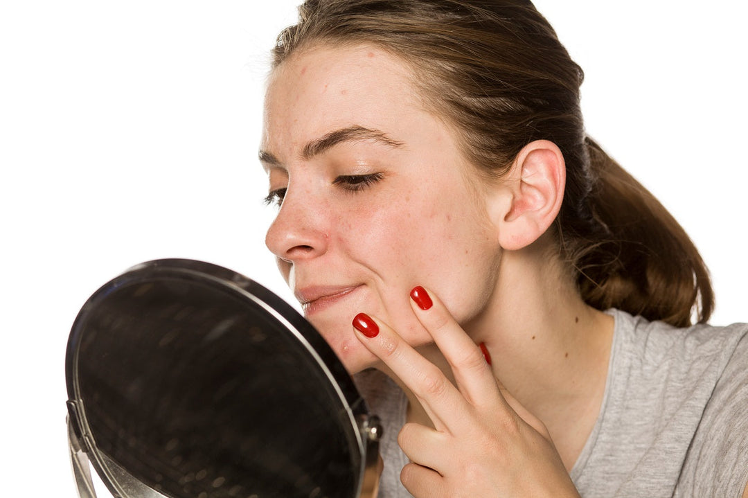 Benzoyl Peroxide Acne Treatment How to use it