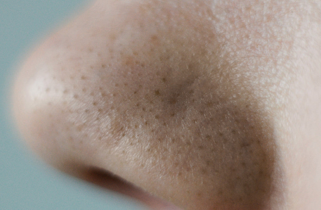 glycolic acid clogged pores