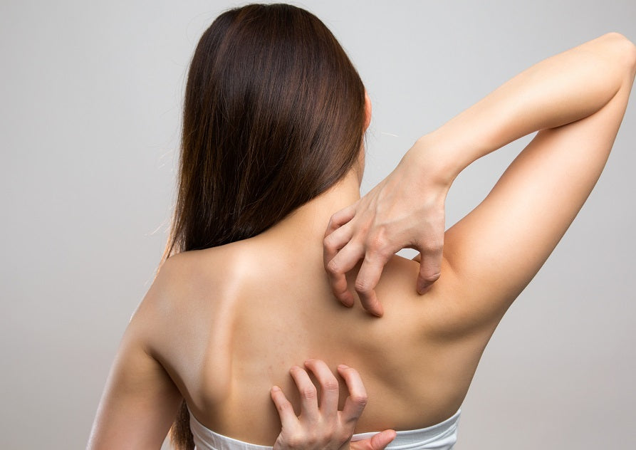 itchy back notalgia paresthetica