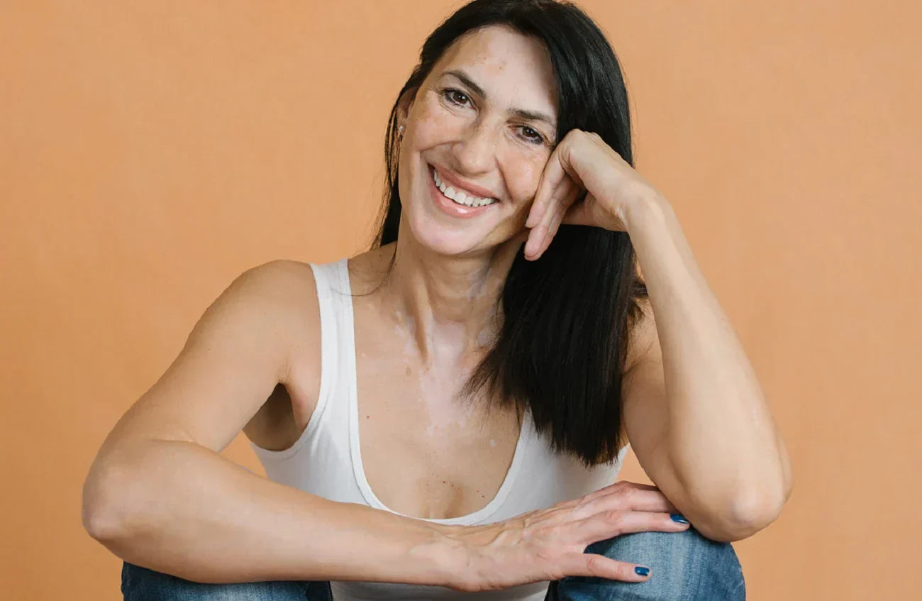 autoimmune diseases and your skin
