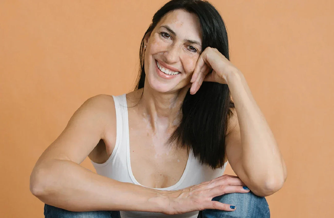 autoimmune diseases and your skin