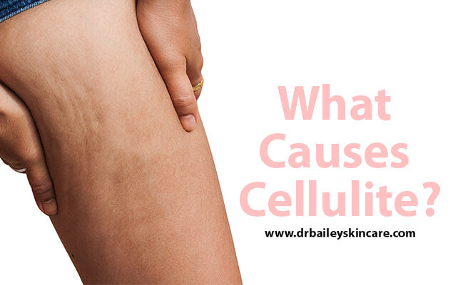 what causes cellulite