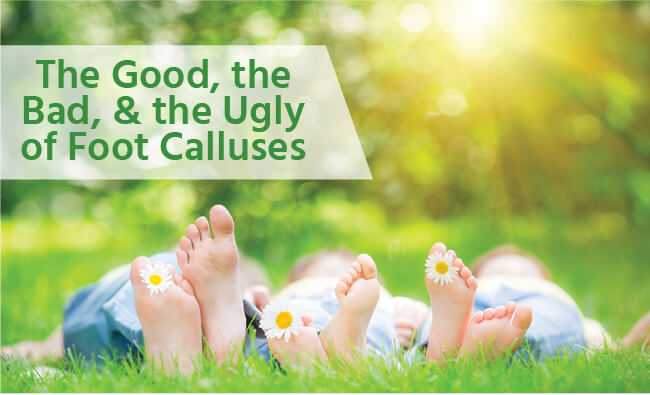 foot calluses are they good
