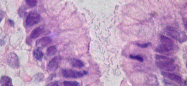 are probiotics good for your health