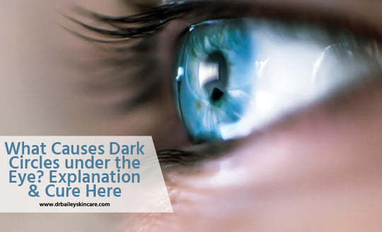 what causes dark circles under the eye