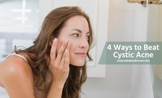 beat cystic acne