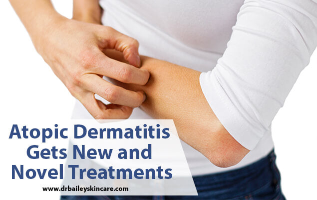 atopic dermatitis new treatment