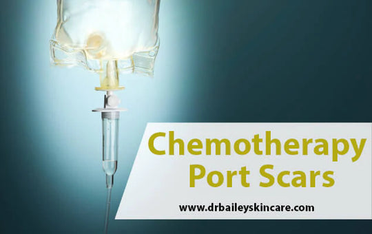 chemotherapy port scars