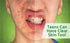 From the Aesthetician: How to Have Clear Skin - Even as a Teen (Yes, Really!)