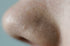 Got Clogged Pores? A How-to Guide for Unclogging Pores: Find it Again Friday