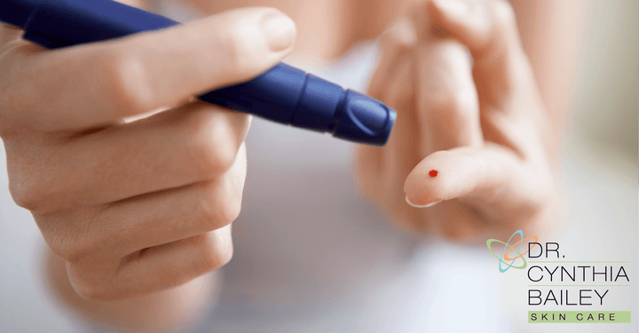 diabetic neuropathy and skin problems