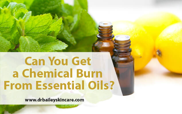 Can you get a chemical burn from essential oils