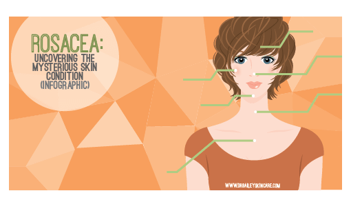 Rosacea infographic dermatologist's