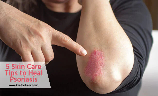 skin care to heal psoriasis