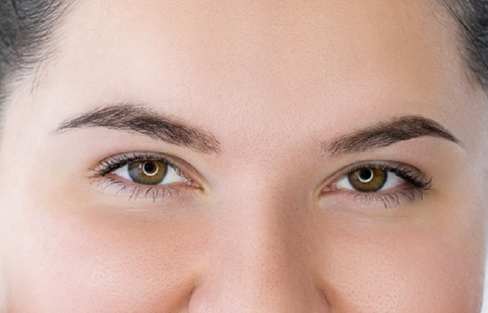 how to treat eczema on your eyelid
