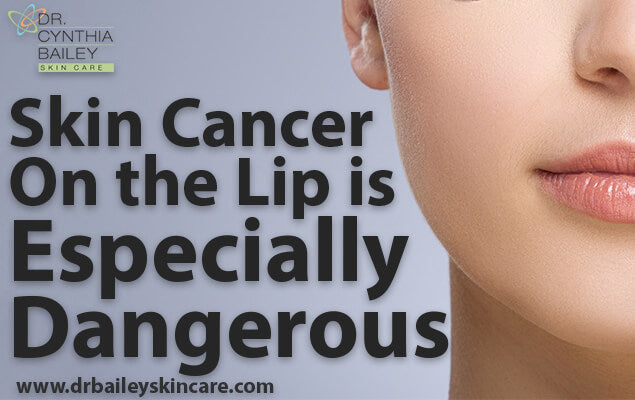 Skin Cancer on the Lip is Especially Dangerous