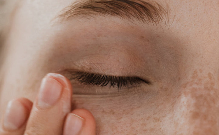 tips for blepharitis