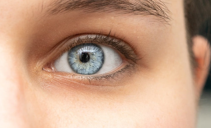 learn what causes dark circles under your eyes