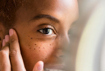 what are sebaceous filaments