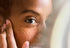 What are Sebaceous Filaments and How to Get Rid of Them