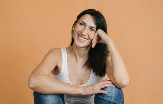 Kim Kardashians dyschromia skin disorder