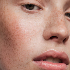sensitive-skin